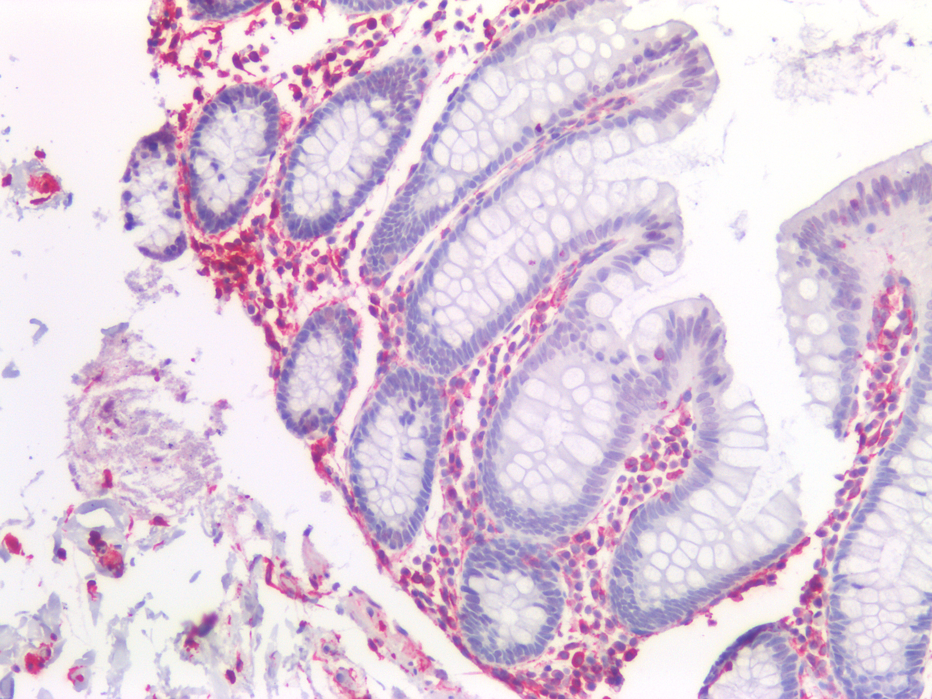 Figure 6. Immunostaining of human paraffin embedded tissue sections of human colon with MUB1903P (diluted 1:100), showing the specific pattern of vimentin in the mesenchymal cell types, such as fibroblasts in the connective tissue, and endothelial cells in blood vessels. As expected, no reactivity is seen in the epithelial cell compartment.